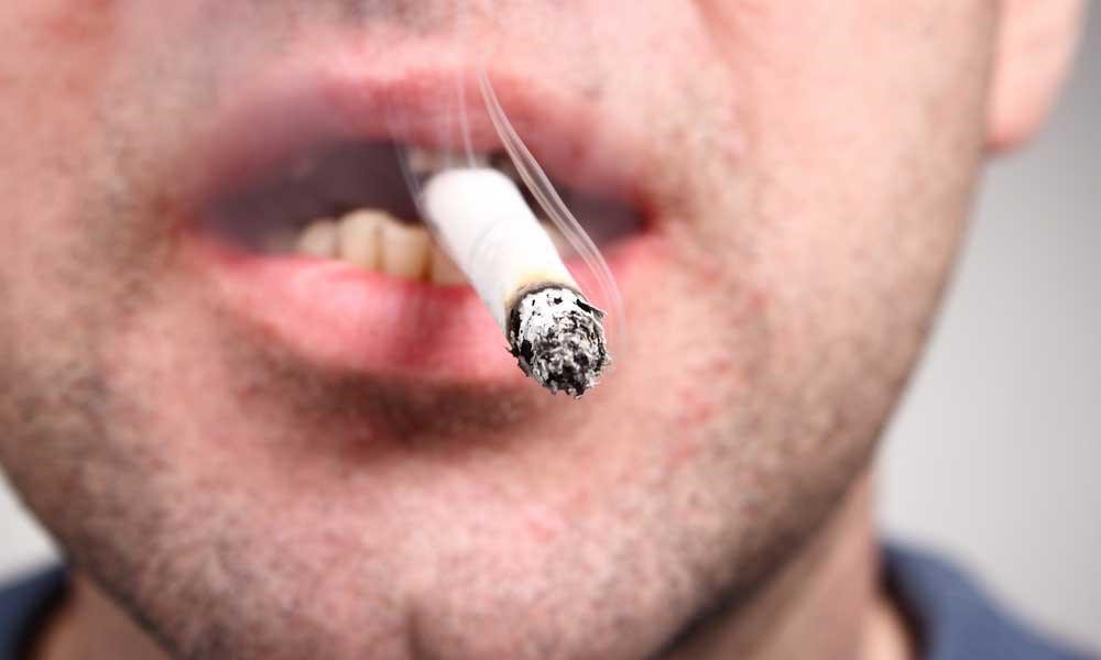مصرف سیگار چه تاثیری بر لمینت دندان دارد؟ 