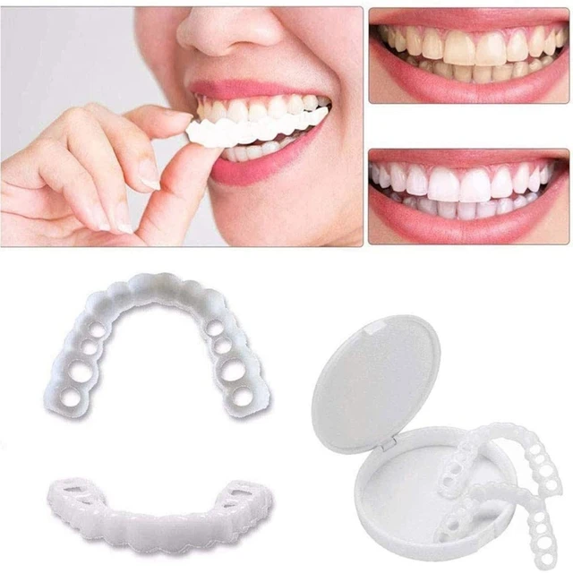 انتخاب بهترین نوع لمینت دندان
