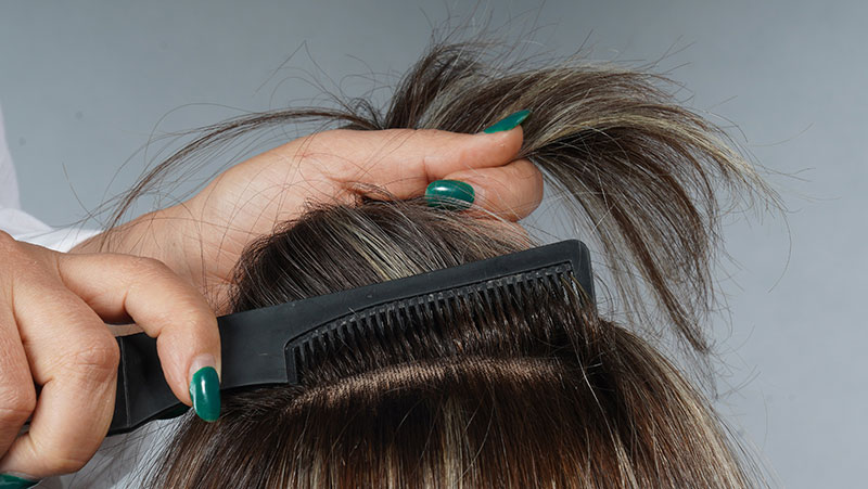 ریزش مو، عوامل و راه‌های درمان آن

