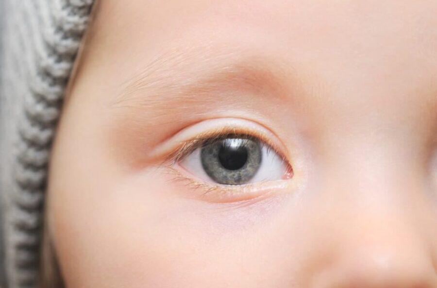 تشخیص اوتیسم با دقت 100% از شبکیه چشم کودکان با هوش مصنوعی