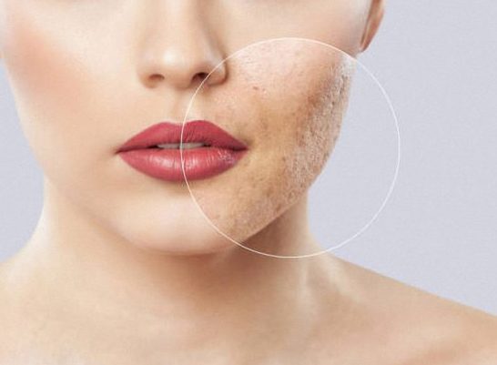 معرفی 10 محصول مراقبتی برای رفع خشکی پوست