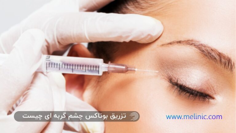 چشم گربه‌ای با بوتاکس: راز زیبایی و گیرایی بیشتر