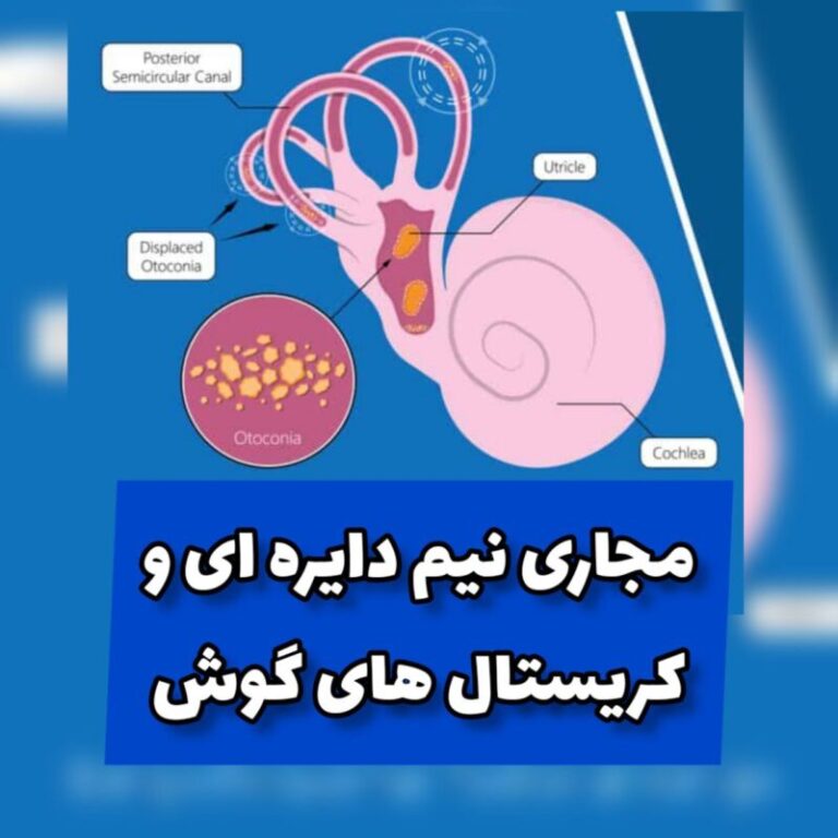 درک سرگیجه: علائم، علل و روش‌های درمان