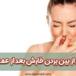 4 روش از بین بردن خارش بعد از عمل بینی