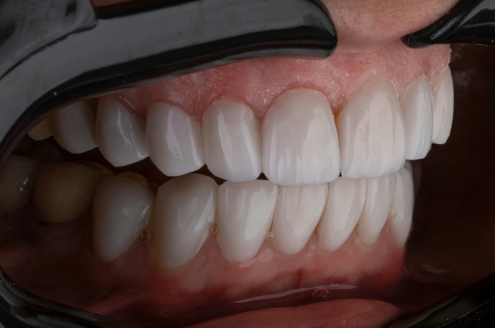 زره ماهی ۵۰۰ میلیونی و درد دندان شما