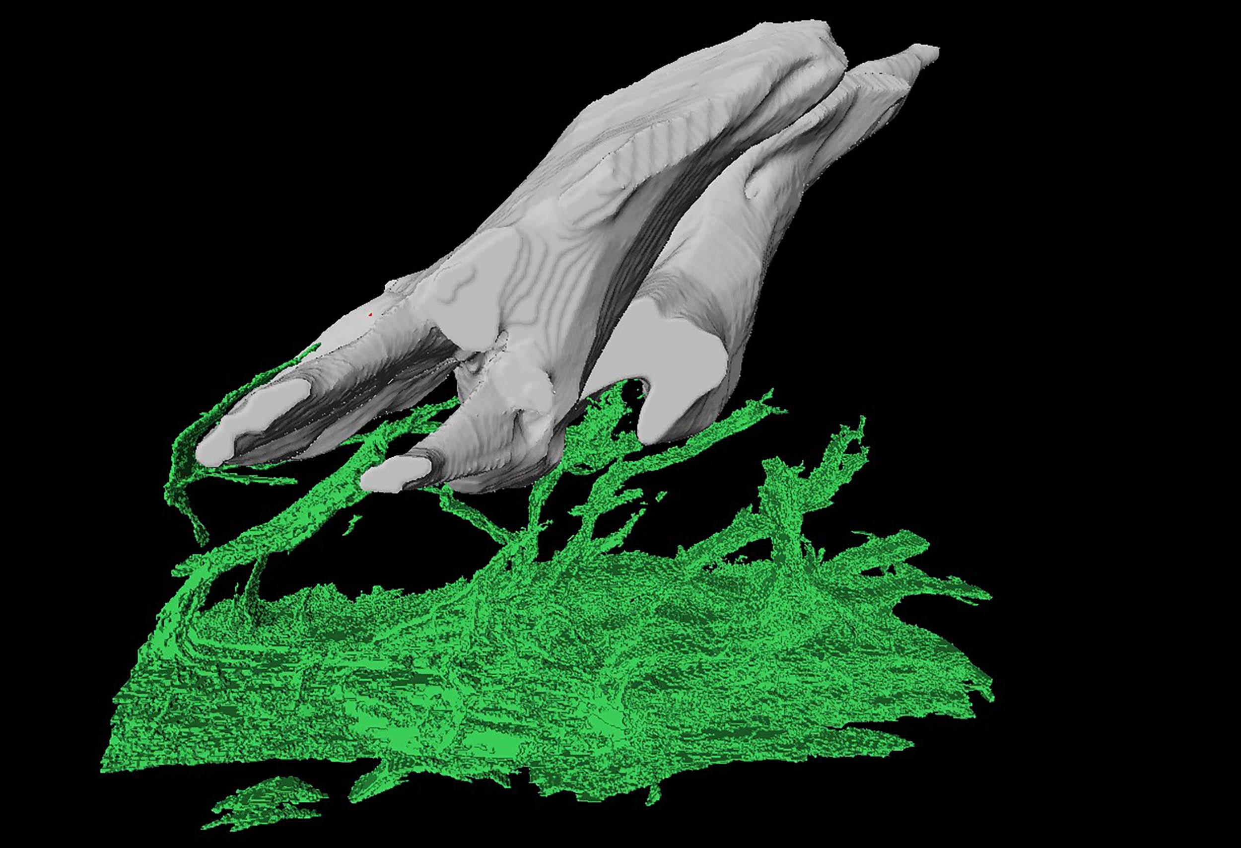 زره ماهی ۵۰۰ میلیونی و درد دندان شما