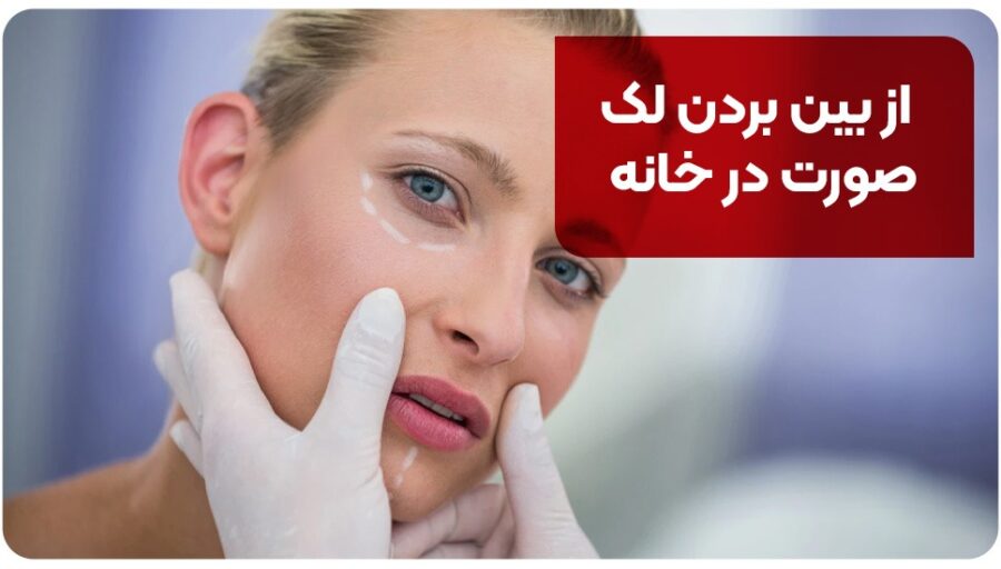از بین بردن لک صورت در خانه با 11 ترفند [+نحوه ساخت ماسک‌های خانگی]