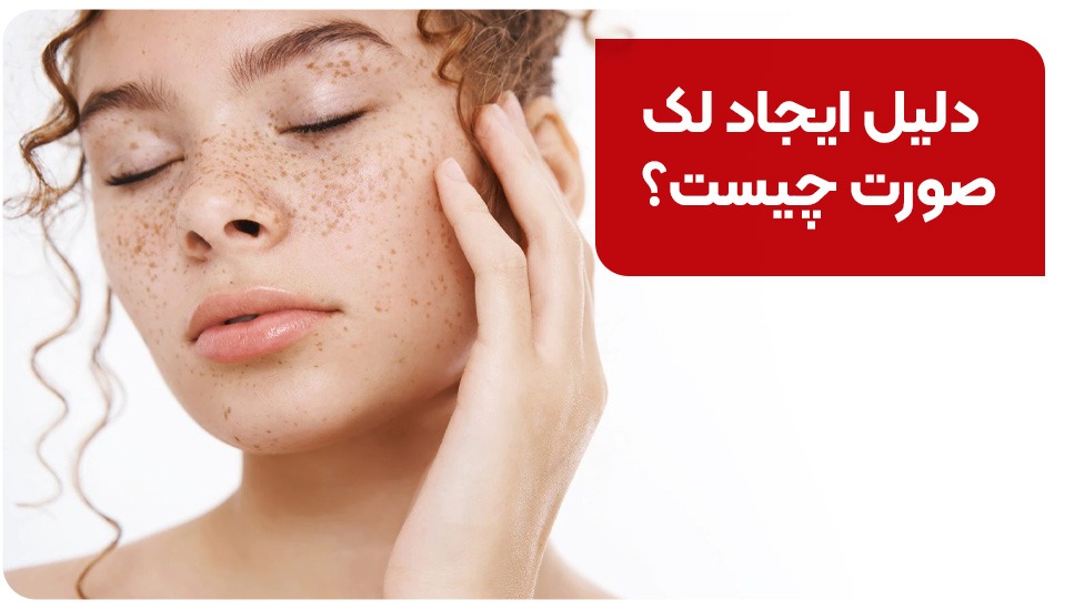 دلیل ایجاد لک صورت چیست؟