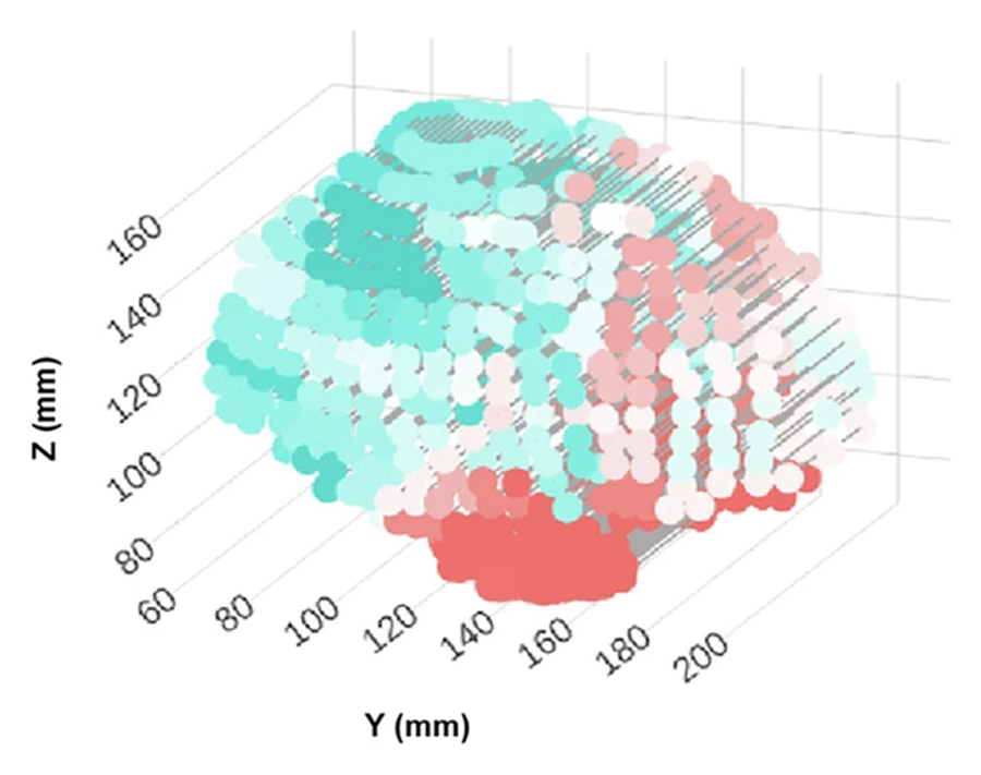 شکل مغز شما می‌تواند زوال عقل آینده را نشان دهد