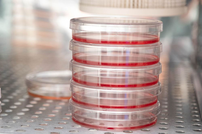 پلیتهای کشت سلولی در آزمایشگاه رودِر که دانشمندان بهتازگی بیان ژنها در سرطان پستان را در آن مطالعه کردند.