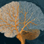 الگوهای مغزی اوتیسم و ADHD ریشه مشترک دارند