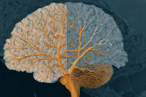 الگوهای مغزی اوتیسم و ADHD ریشه مشترک دارند