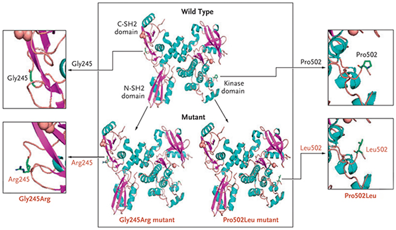 اختلالات پروتئین ZAP70 نقش کلیدی در این تحقیق داشت