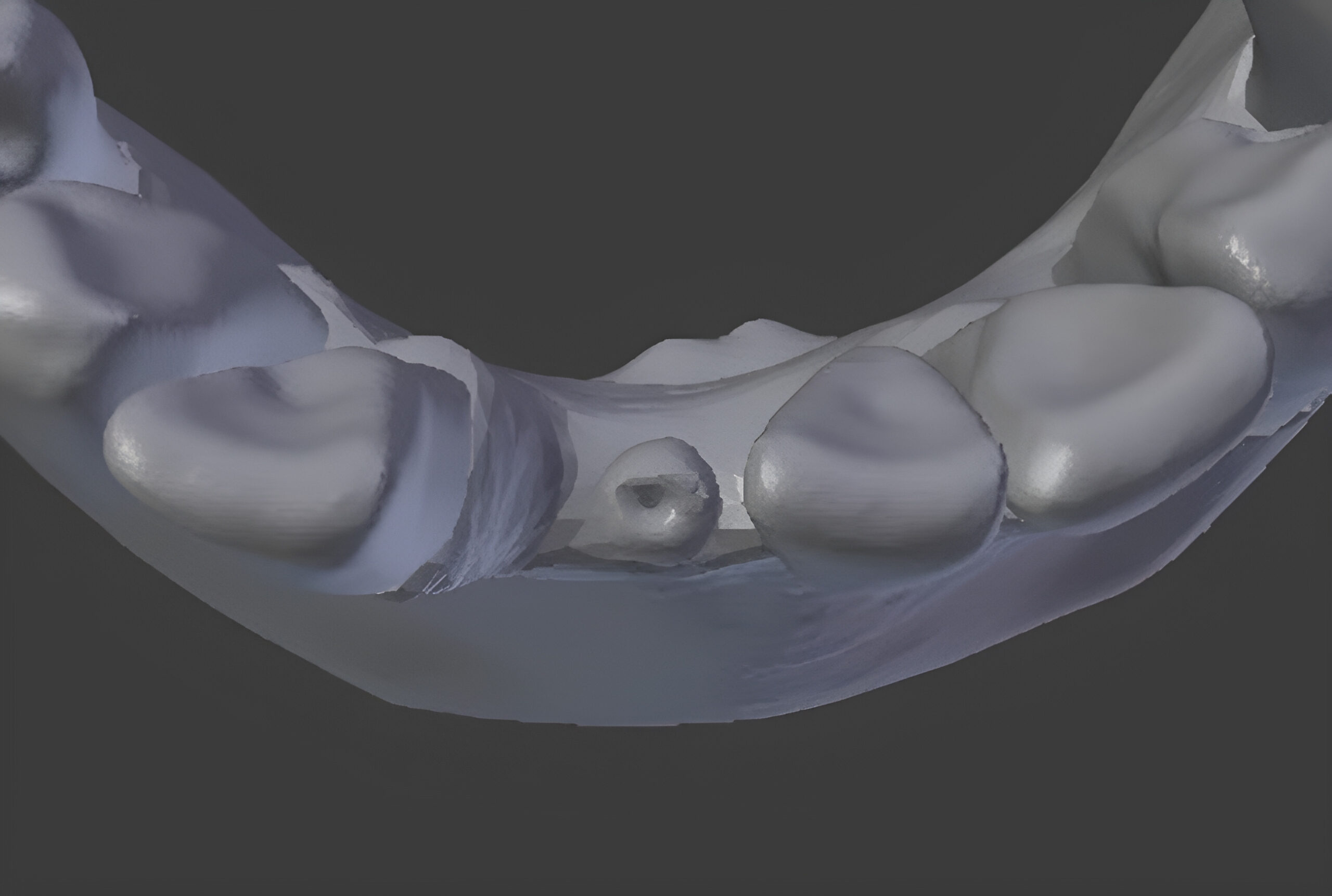 جهش بزرگ ایران در تولید پیوند استخوانی پیشرفته با چاپگر سه‌بعدی هوشمند